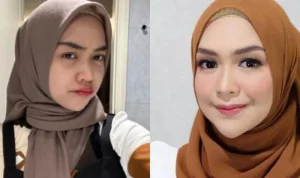 Klarifikasi Ria Ricis Operasi Hidung: Alasan Kesehatan, Estetika, dan Reaksi Netizen