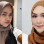 Klarifikasi Ria Ricis Operasi Hidung: Alasan Kesehatan, Estetika, dan Reaksi Netizen