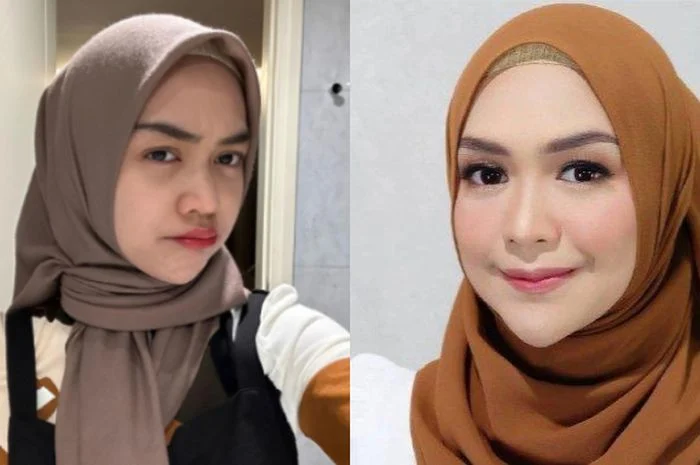 Klarifikasi Ria Ricis Operasi Hidung: Alasan Kesehatan, Estetika, dan Reaksi Netizen