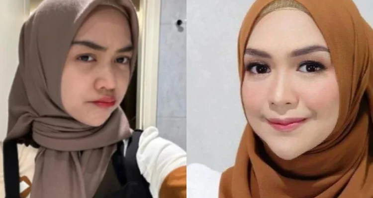 Ria Ricis Operasi Hidung: Alasan Medis, Reaksi Netizen, dan Estimasi Biaya yang Membuat Geger