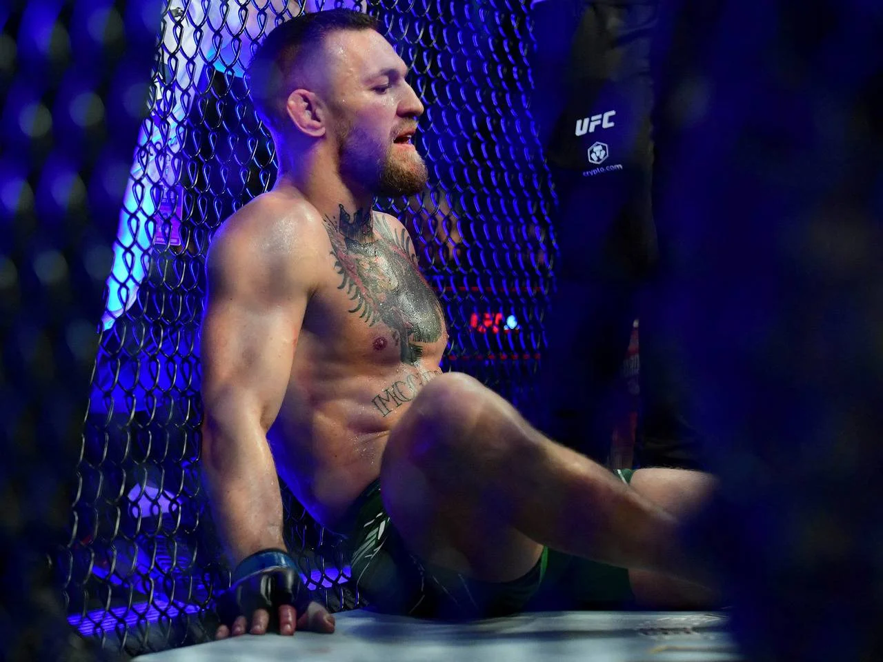Conor McGregor Mengalami Cedera Parah, Karirnya di UFC Terancam Berakhir